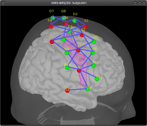 cortical scout