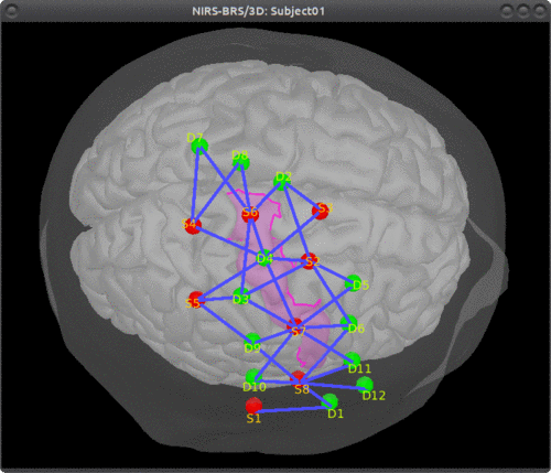 cortical scout